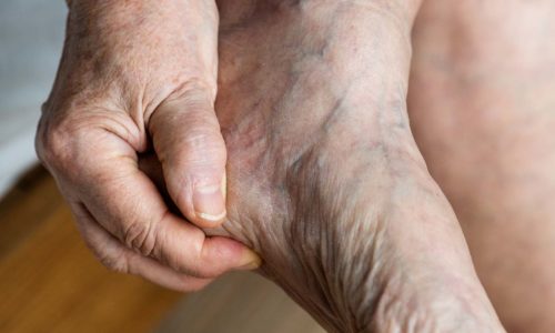 Soins et hygiènes des pieds et des mains de la personne âgée